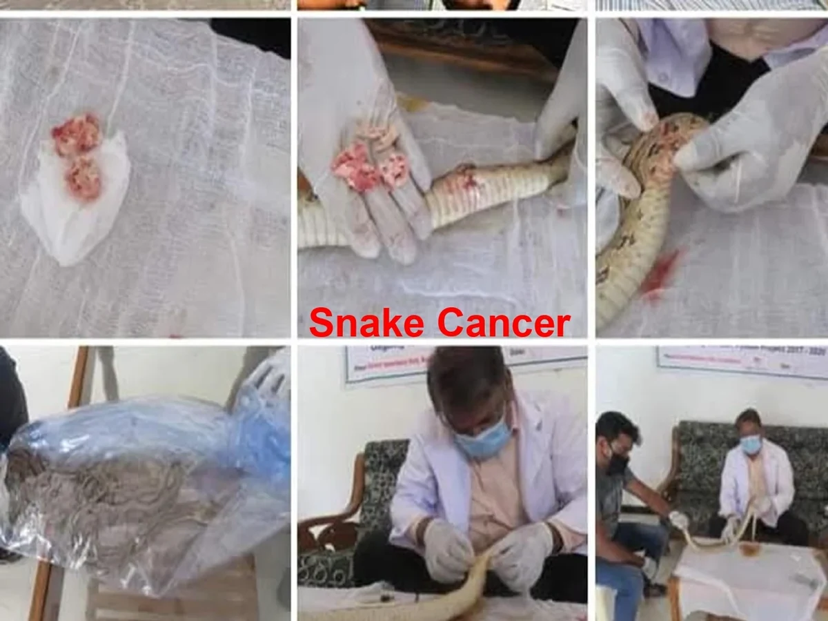 snake cancer surgery treatment real